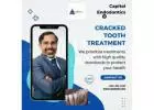 Cracked Tooth Treatment | Capitol Endodontics