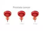 With Agilus Diagnostics' PSA Blood Test, Put Your Prostate Health First