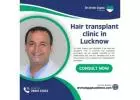 Hair transplant clinic in lucknow