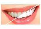 teeth whitening dentist | teeth whitening cost Bangalore