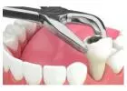 Dental implants Summerlin by functionalaestheticdentistry.com
