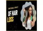 Wigs For Medical Hair Loss | Wigmedical.com