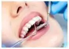 !Avoid mouthwash TOP dentists warn