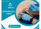 A Comprehensive Guide to Sclerotherapy Costs