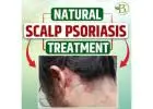 Understanding Psoriasis and Its Impact and treatment