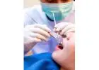 Dental Pit & Fissure Sealants Treatment & Cost