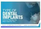 Dental Implants in Gurgaon - MOS
