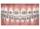 Gibb Orthodontics: Best Dentist Lethbridge 