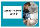 HOW MUCH DOES SCLEROTHERAPY COST? A COMPREHENSIVE GUIDE