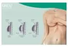 Breast Lift and Reduction Surgery in Bangalore - Anew Aesthetic Daycare