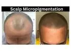 Scalp Micropigmentation - Hair Savvy Studio