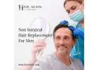 best non surgical hair replacement