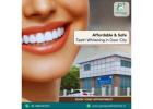  Affordable & Safe Teeth Whitening in Gaur City