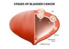 Best Urology Specialist in Noida Sector 104 | Expert Urological Care