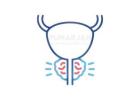 Best Prostate Cancer Treatment Hospitals in Hyderabad