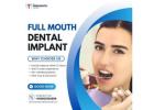 Unlock a New Smile with Full Mouth Dental Implants – Expertise You Can Trust!