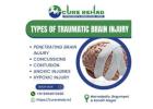 Traumatic Brain Injury Care Services | TBI Rehabilitation Hyderabad