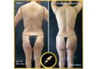 Fat Transfer to Butt–Fuller, Natural Curves in Los Angeles