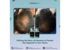 Utilizing the Power of Exosomes to Promote Hair Regrowth in Your Clients