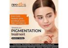 Skin Pigmentation Treatment in Hyderabad | Skin Pigmentation| Neo skin clinic