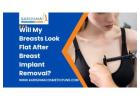Flat After Breast Implant Removal
