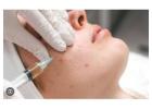 Professional Acne Scar Treatment Birmingham