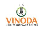 Hair Specialist Doctor in Hanamkonda