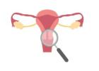 Intramural Leiomyoma of Uterus – Causes, Symptoms - Best Treatment Options