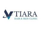 Vtiara Skin Care Clinic in Bangalore – Your Destination for Radiant Skin