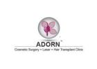 Best Laser Hair Removal Treatment Ahmedabad