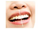 Get a Brighter Smile with Professional Teeth Whitening in Burton!