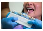 Porcelain Veneers at Best Price – Safe & Aesthetic Solution