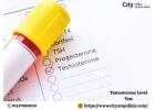 Testosterone Level Test Price & What to Expect
