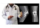 Total knee replacement in India
