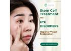 Stem Cell Treatment for Eye Disorders: Hope for Visual Restoration
