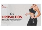 Vaser Liposuction Surgery In Delhi & Gurgaon 