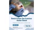 Dental Crowns in San Francisco and West Portal | Anchor Dental