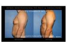 Male Breast Reduction New York for Gynecomastia Treatment