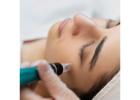 Microneedling Indianapolis