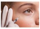 Discover a Trusted Expert Botox Clinic in San Jose