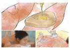 Ayurvedic doctors in New York City