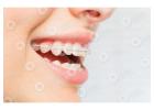 Orthodontic Treatment in Dubai | Invisible Braces Dubai