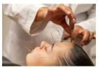 Acupuncture Support for Menopause in Hertford