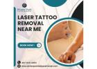 Trusted Laser Tattoo Removal Near Me – Safe, Fast & Effective