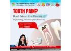 Best Root Canal Treatment Clinic in Nellore