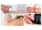 Best Acupuncture Therapy Near Me for Natural Pain Relief