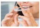 Invisalign in Charlotte, NC – Straighten Your Smile Today