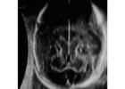 Exploring the Wonders of Fetal Neurosonography |  Fetal India