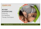 Your Comfort is Our Priority During Dry Needling