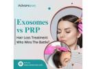 Exosomes vs PRP in Hair Loss Treatment: Who Wins the Battle?